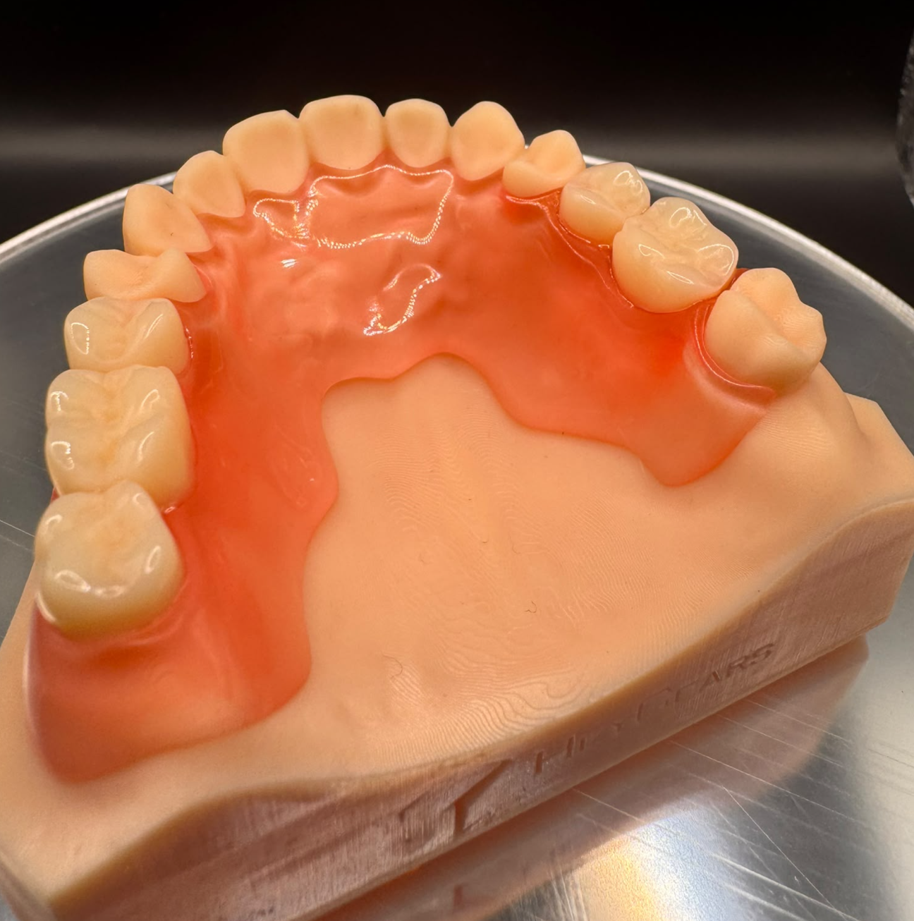 Pink partial denture with posterior replacement teeth seated on an upper dental model