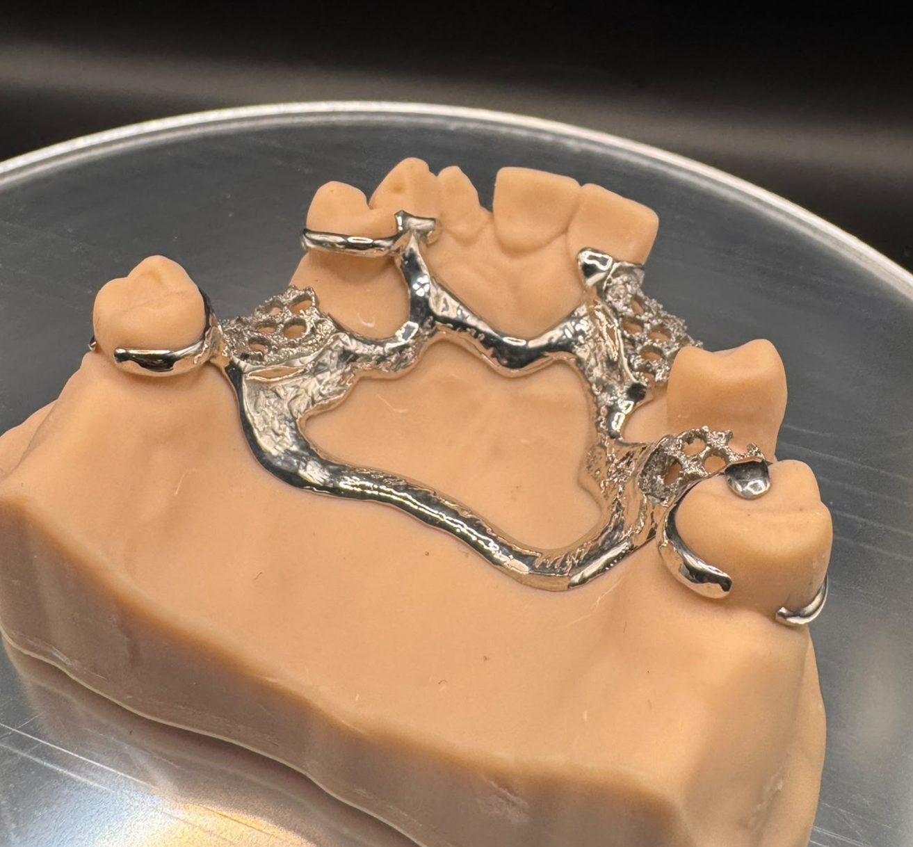 Polished metal partial denture framework with clasps and mesh sections seated on a dental model