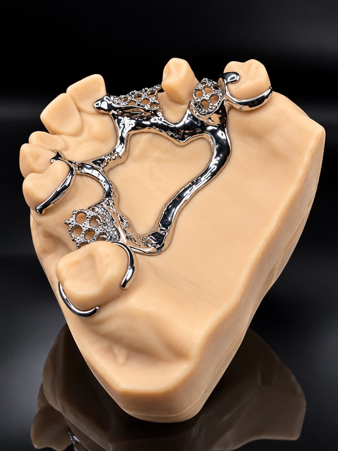 Metal partial denture framework viewed from above on an upper dental model