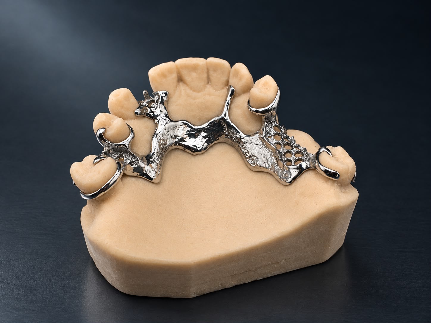 Front view of a polished metal partial denture framework seated on a dental model