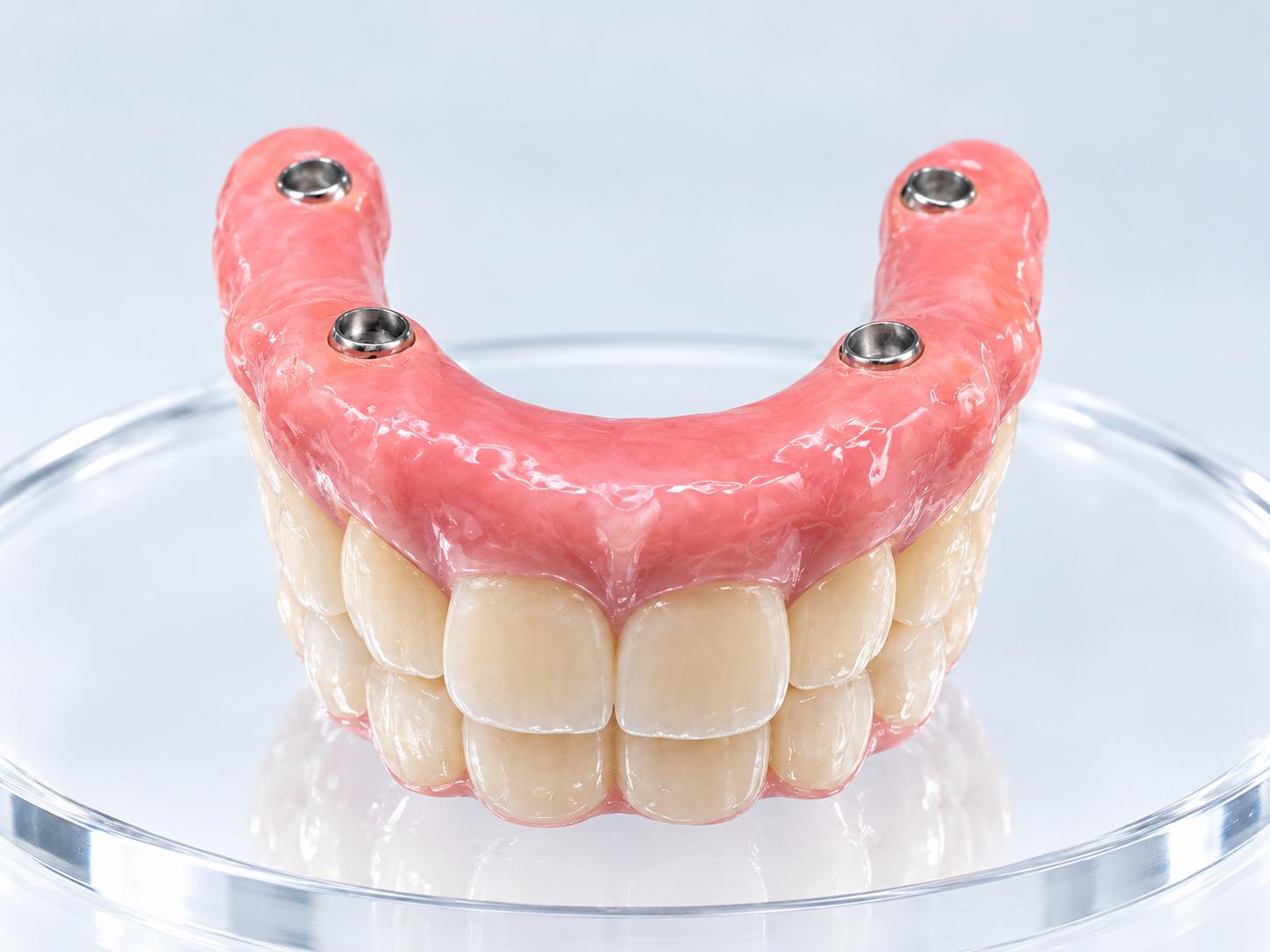 Underside of a pink implant-supported full-arch restoration with four metal connection openings