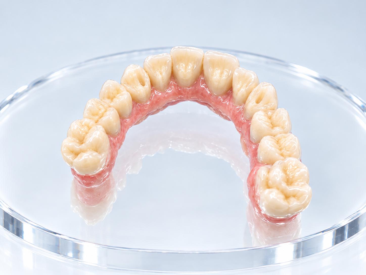 View from above of an implant-supported full-arch restoration showing the tooth surfaces and pink base