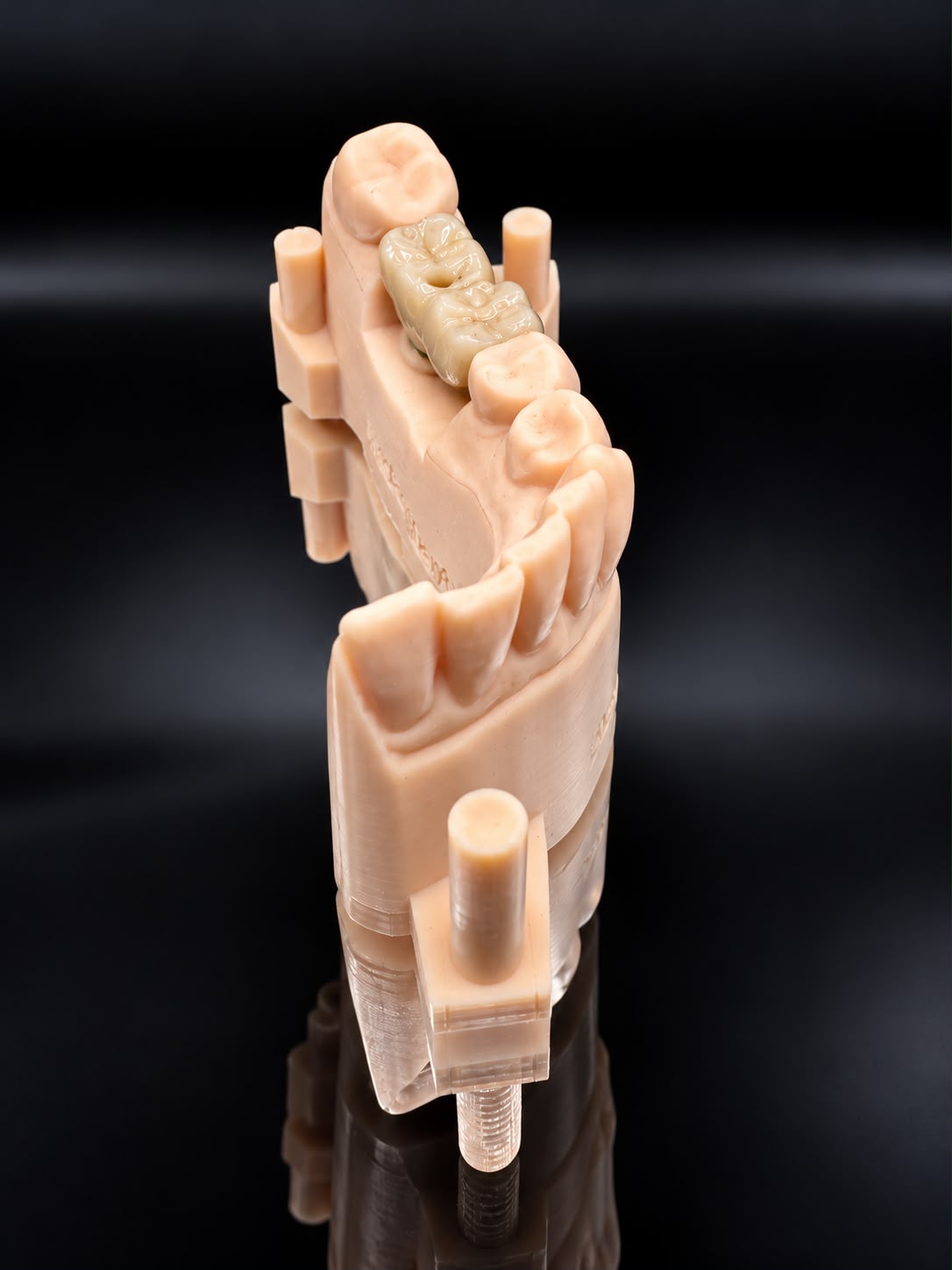 Tooth-coloured bridge on a Proslab dental model, viewed along the dental arch