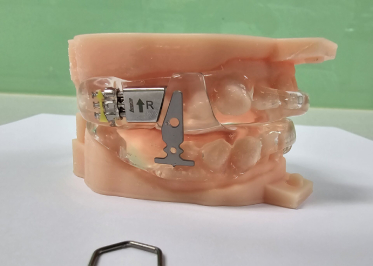 Dorsal appliance, from the Dental Sleep Lab catalogue