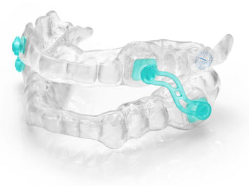 Silensor appliance, from the Dental Sleep Lab catalogue