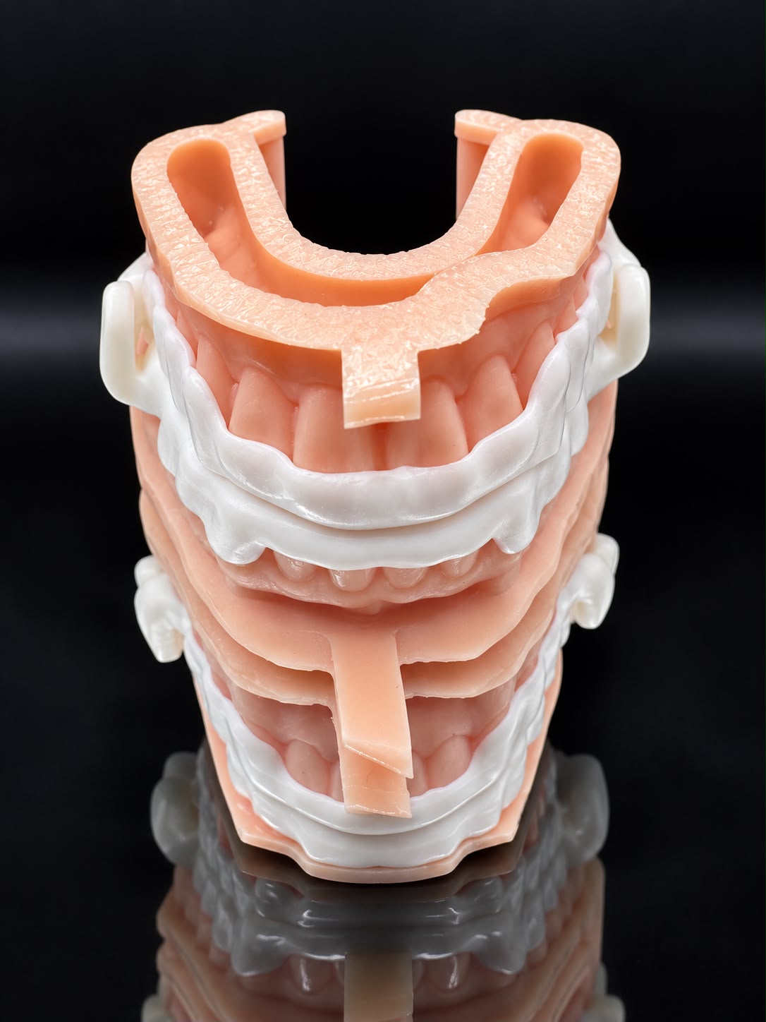 White Nylon Dorsal sleep appliance on upper and lower dental models